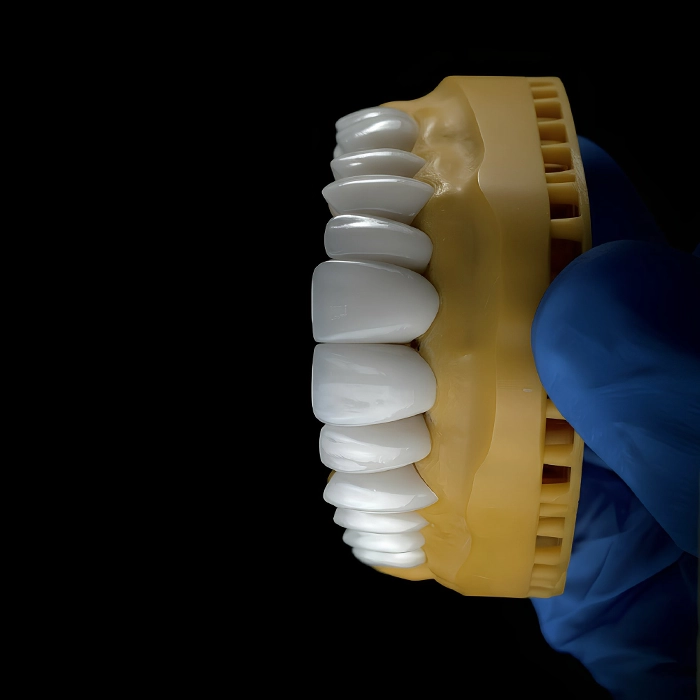 IMPLANT SOLUTIONS