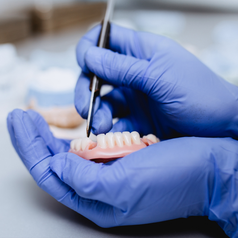 All-on-4 Dental Implant Procedure in Turkey: A New Smile at İnci Diş
