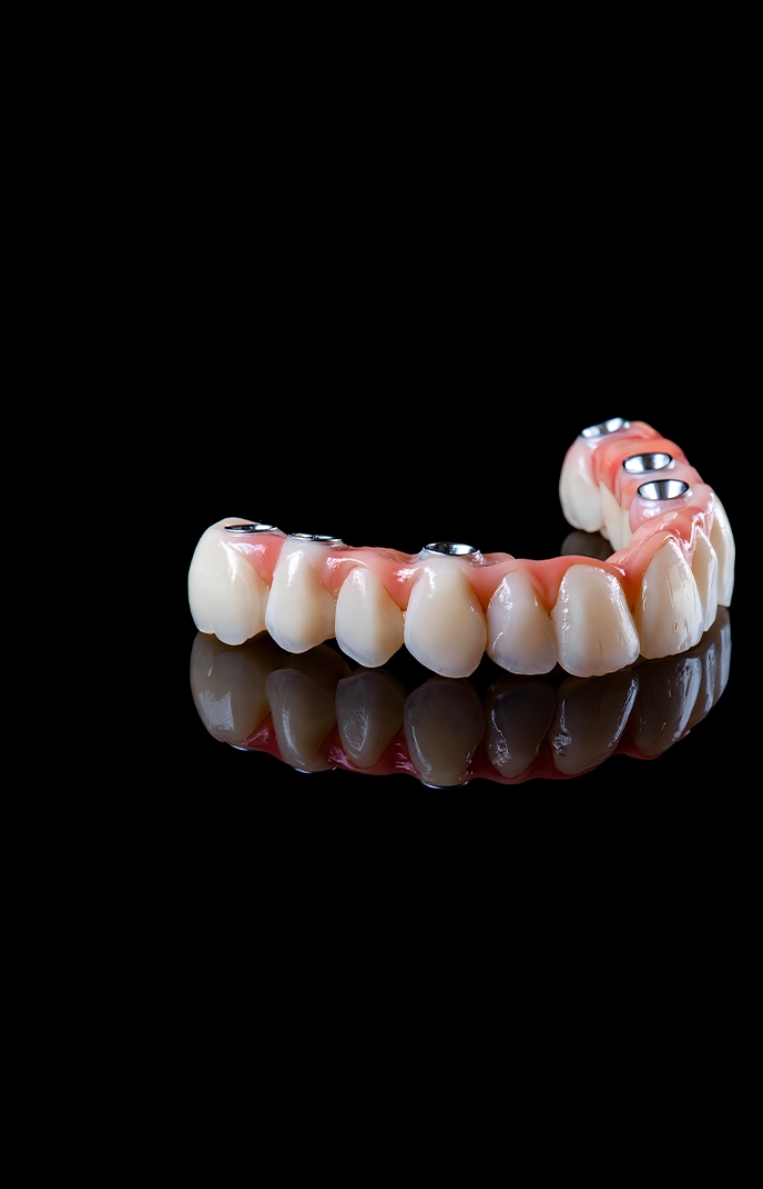 All on 6 Implants in Turkey