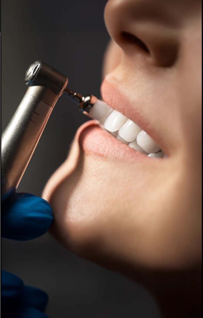 Dental Cleaning & Polishing