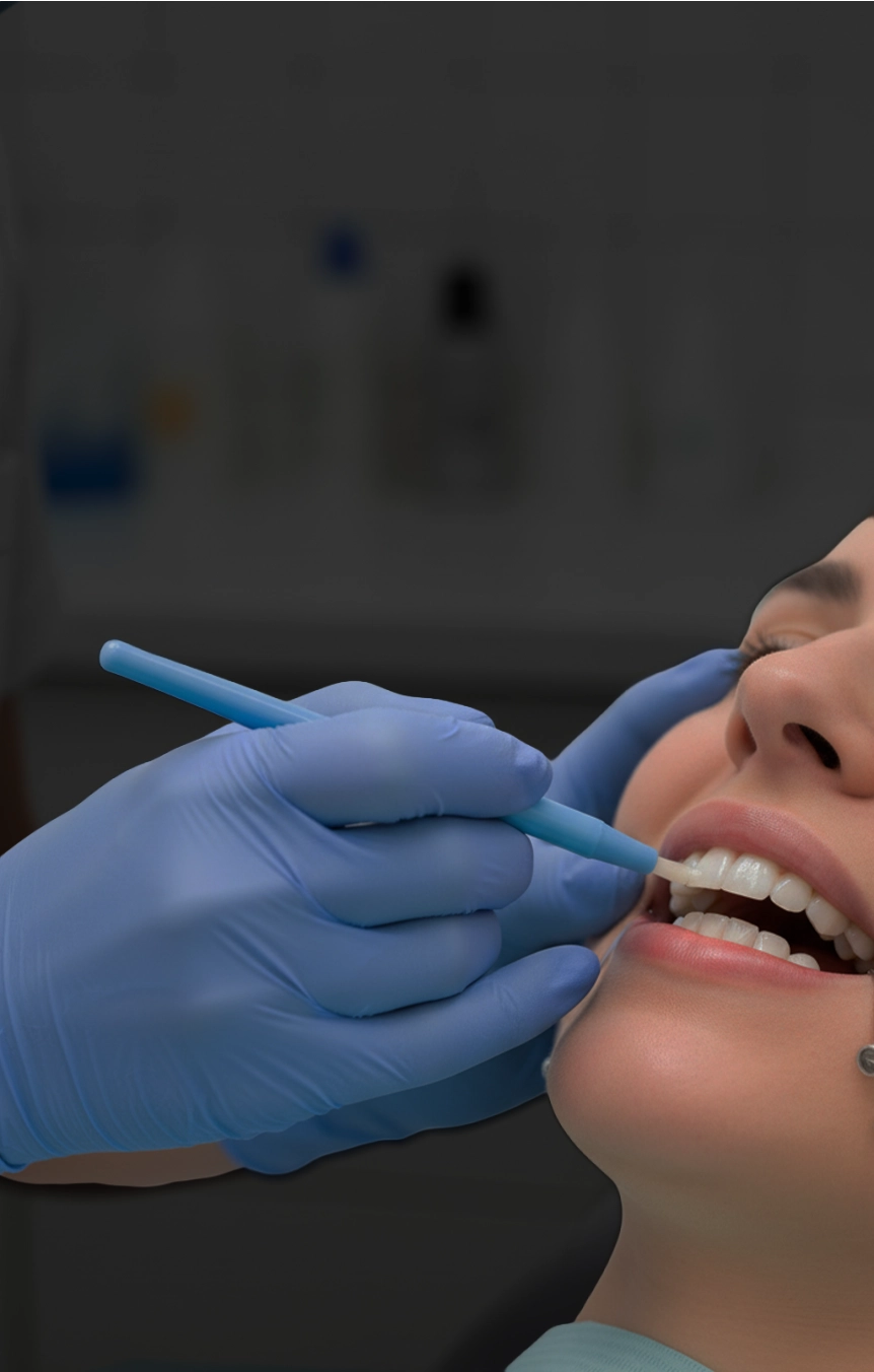 Fluoride Treatment 