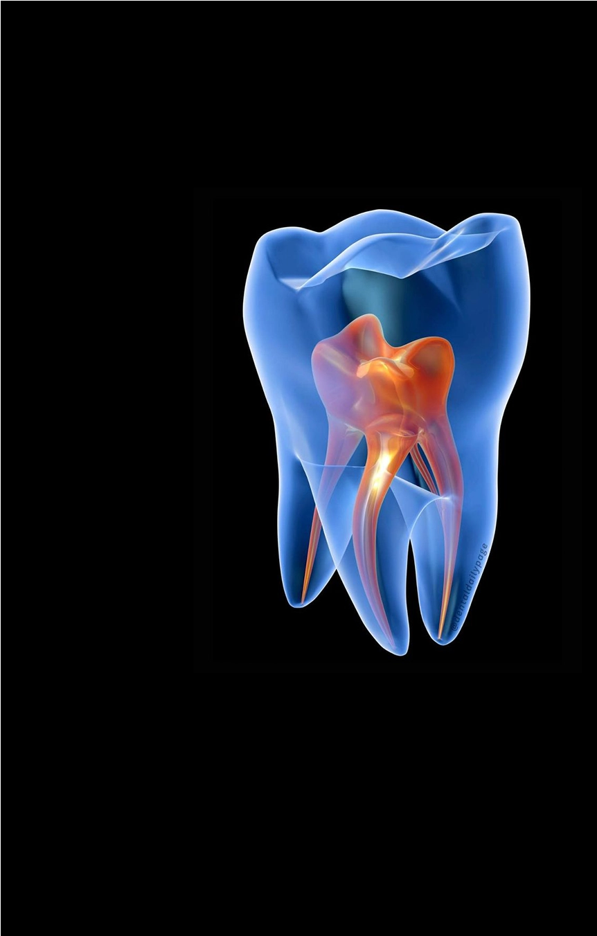  Root Canal Treatment