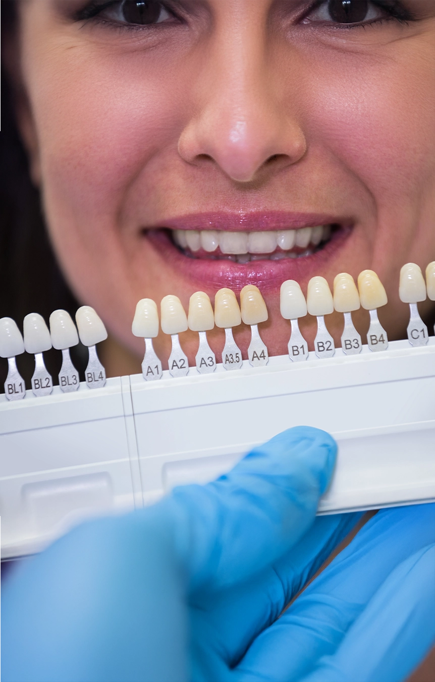 Tooth-Colored Fillings