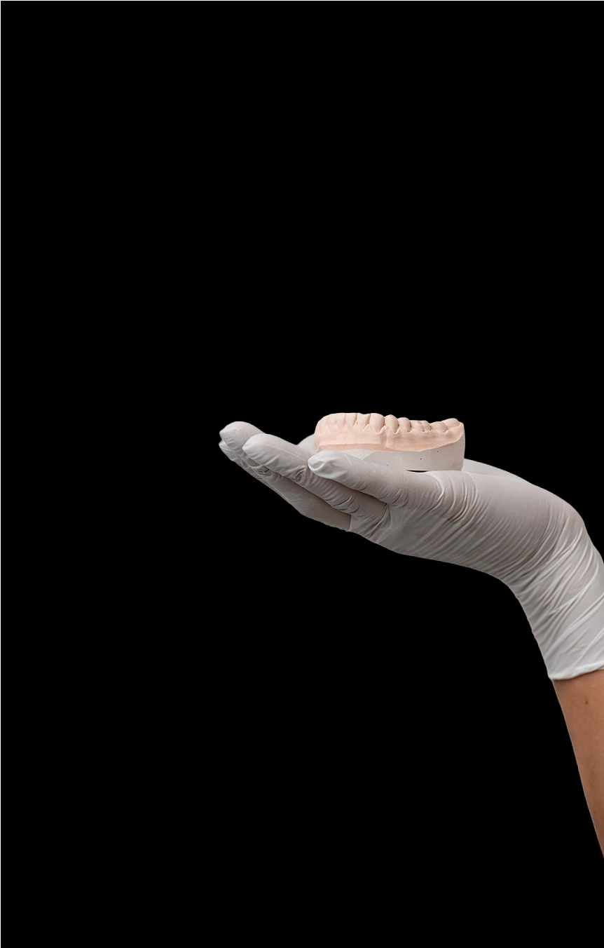 Implant Overdentures