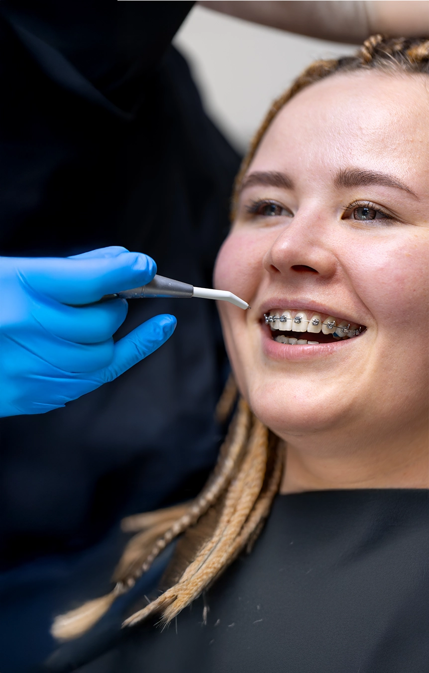 Orthodontic Braces 