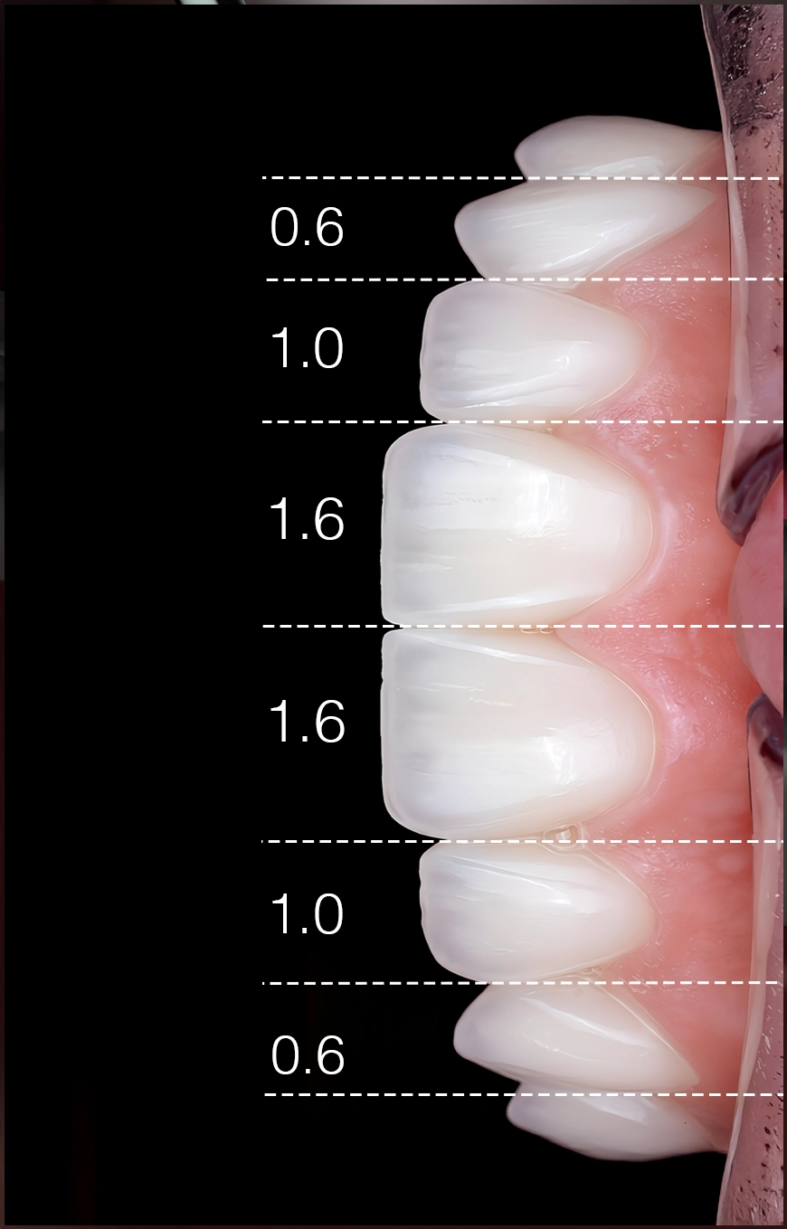 Digital Smile Design